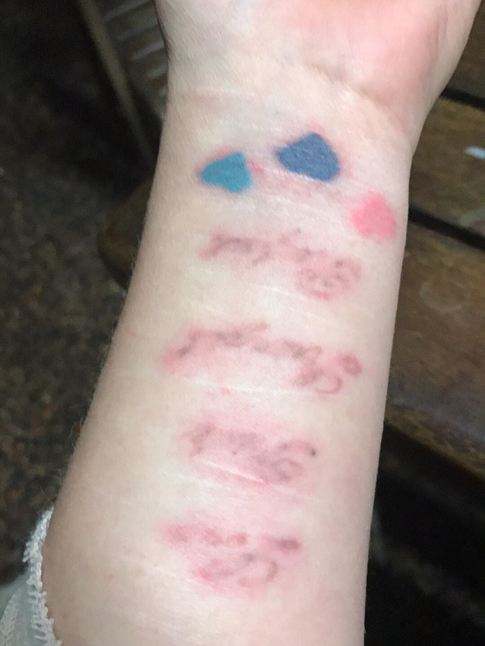 Central Coast Tattoo Removal Skin Treatments Beauty Treatments